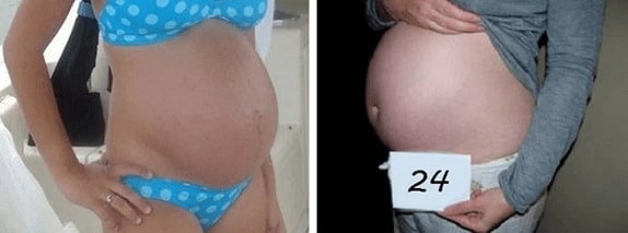 24 Haftalık Hamile Göbeği