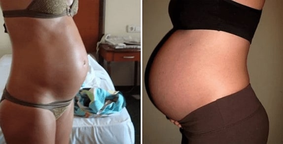 26 Haftalık Hamile Göbeği