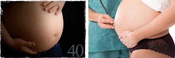 40 Haftalık Hamile Göbeği