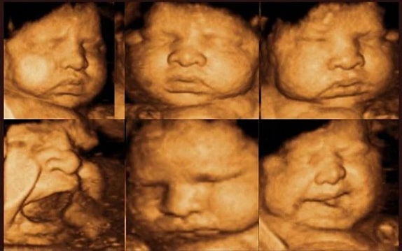 42 Haftalık Bebek Ultrason Görüntüsü