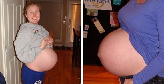 42 Haftalık Hamile Göbeği