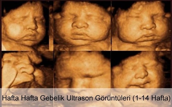 Hafta Hafta Gebelik Ultrason Görüntüleri (1 - 14 Hafta) Hafta Hafta Gebelik Ultrason Görüntüleri (1 - 14 Hafta)