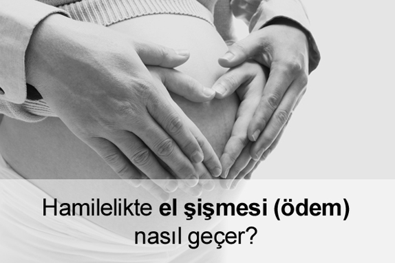 Hamilelikte (Gebelikte) El Şişmesi (Ödem) Nasıl Geçer?