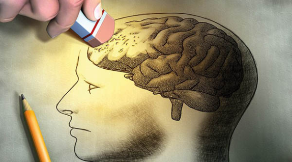 Alzheimer Gerçekleri Alzheimer Gerçekleri