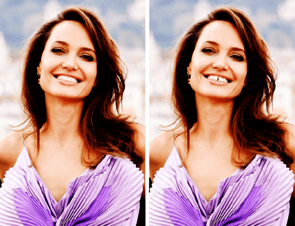 Angelina Jolie Dişleri