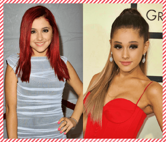 Ariana Grande Estetik Öncesi ve Sonrası