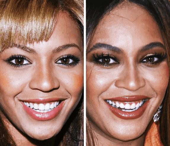 Beyoncé - 21 Yaş ve 37 Yaş