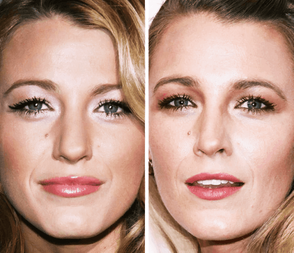 Blake Lively - 22 Yaş ve 30 Yaş