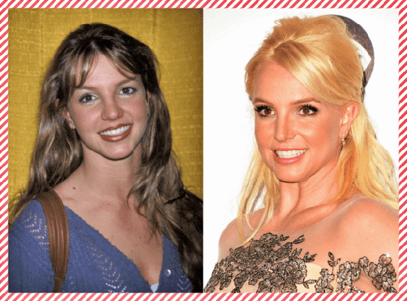 Britney Spears Estetik Öncesi ve Sonrası