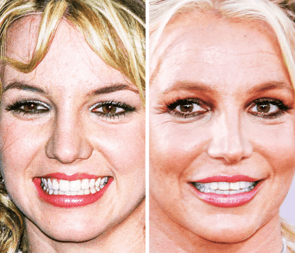 Britney Spears - 17 Yaş ve 37 Yaş