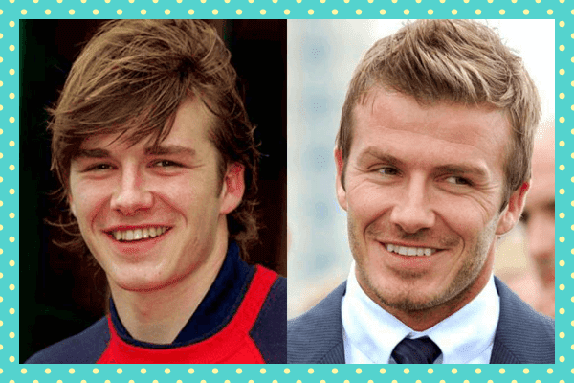 David Beckham Eski Yeni Dişleri