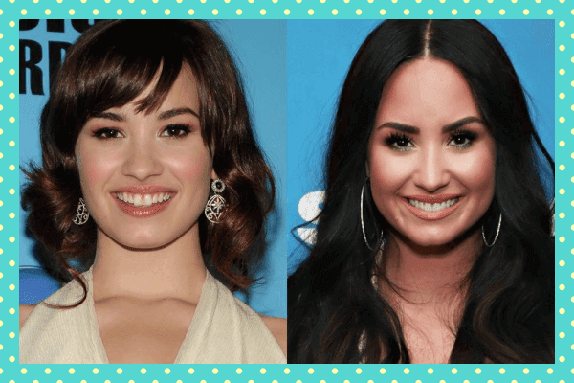 Demi Lovato Eski Yeni Dişleri
