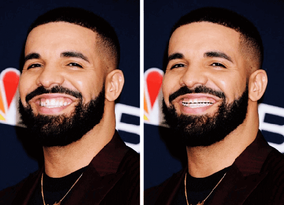 Drake Dişleri