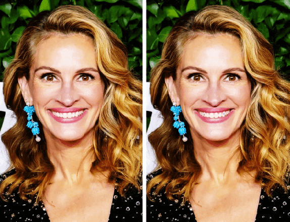 Julia Roberts Dişleri