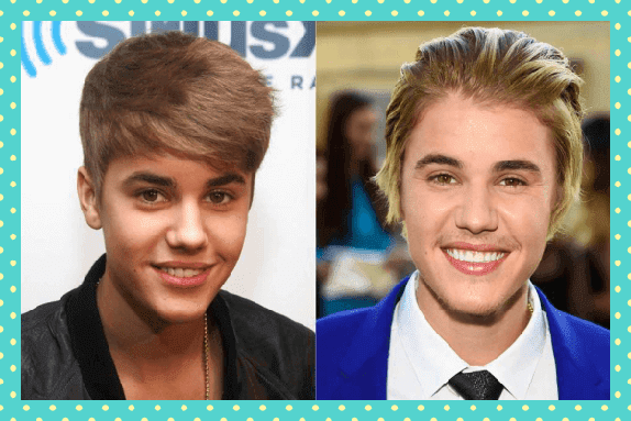 Justin Bieber Eski Yeni Dişleri
