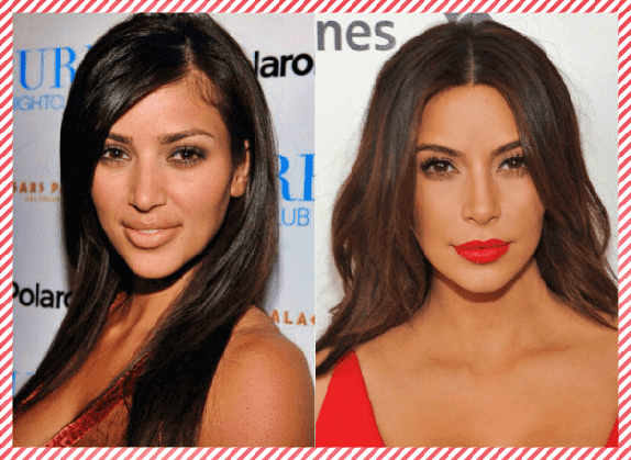 Kim Kardashian Estetik Öncesi ve Sonrası