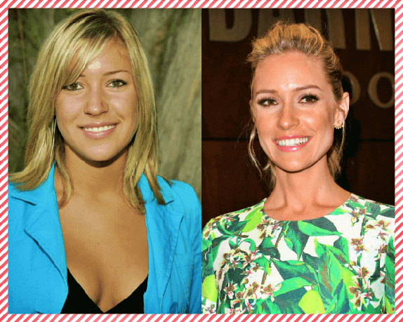 Kristin Cavallari Estetik Öncesi ve Sonrası Kristin Cavallari Estetik Öncesi ve Sonrası