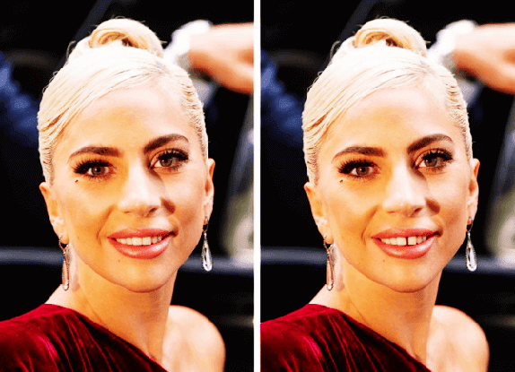 Lady Gaga Dişleri