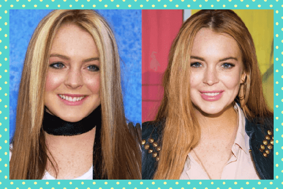 Lindsay Lohan Eski Yeni Dişleri