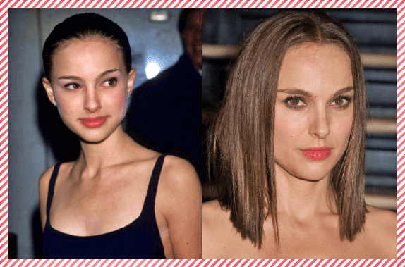 Natalie Portman Estetik Öncesi ve Sonrası