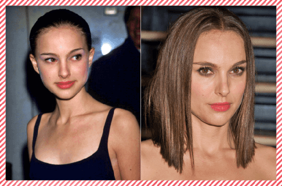 Natalie Portman Estetik Öncesi ve Sonrası Natalie Portman Estetik Öncesi ve Sonrası