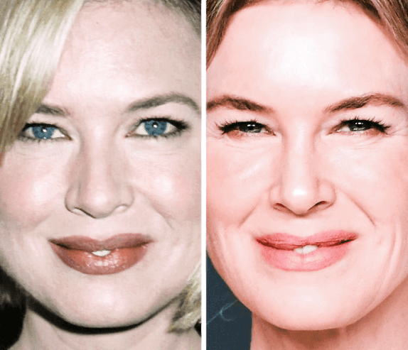 Renée Zellweger - 34 Yaş ve 50 Yaş