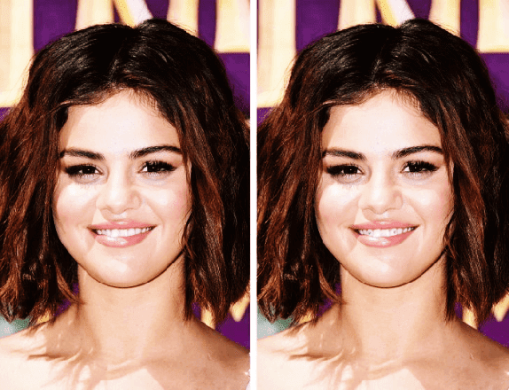 Selena Gomez Dişleri