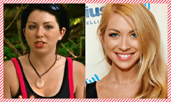 Stassi Schroeder Estetik Öncesi ve Sonrası Stassi Schroeder Estetik Öncesi ve Sonrası