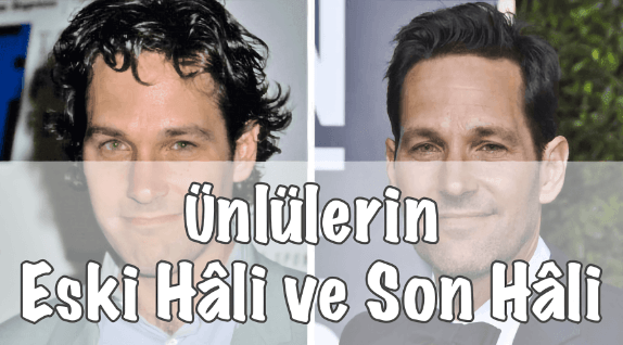 Ünlülerin Eski Hâli ve Yeni Hâli Ünlülerin Eski Hâli ve Yeni Hâli