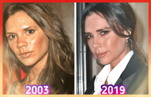 Victoria Beckham Eski Hâli ve Son Hâli Victoria Beckham Eski Hâli ve Son Hâli