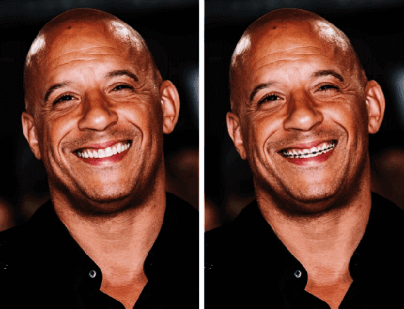 Vin Diesel Dişleri